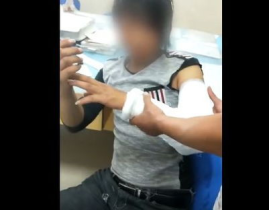 吃瓜网红猝死视频,大胃王背后的健康危机
